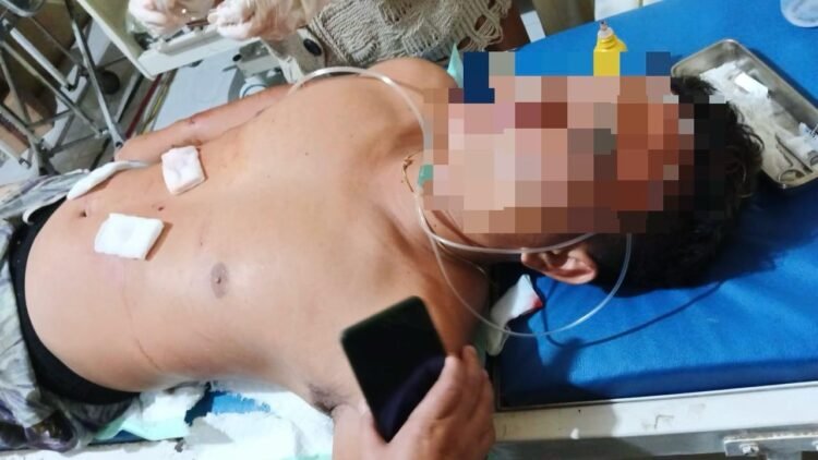 Mandi di Sungai, Pemuda di Lamin Nyaris Tewas Diterkam Buaya