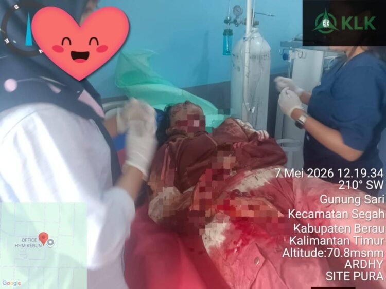 Korban Pembacokan di Segah Jalani Rujukan Ke Samarinda