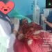 Korban Pembacokan di Segah Jalani Rujukan Ke Samarinda
